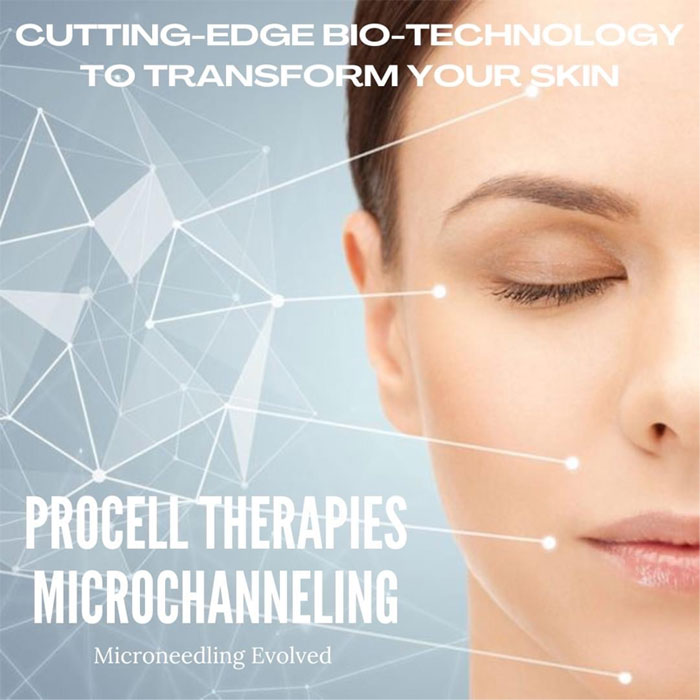 Procell Microchanneling